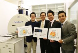 2017.01.26 Innovative neuroimaging tool adopted by Professor Ed Wu to unravel complex brain networks